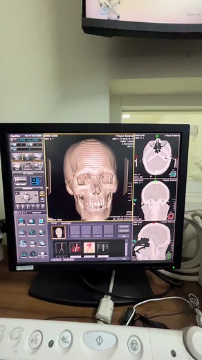 CT Scan Kepala - Diagnostic Imaging with CT Simulator