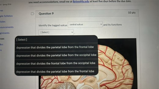 Identify the tagged sulcus [central sulcus] and its functions. ... | Filo