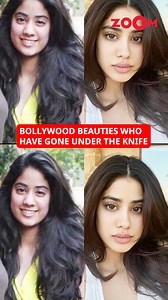 5.6K views · 34 reactions | Bollywood actresses who got cosmetic surgery to look even more beautiful and confident, changing their looks and lives forever. #zoomtv #cosmeticsurgery #bollywoodsurgery #surgery #plasticsurgery | Zoom TV | Facebook