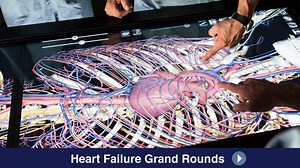 Heart failure in the adult with congenital heart disease - Mayo Clinic