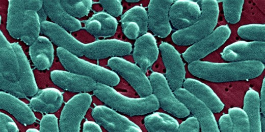 CDC Warns About 'Flesh-Eating' Bacteria In East Coast Waters—Experts Explain The Risk