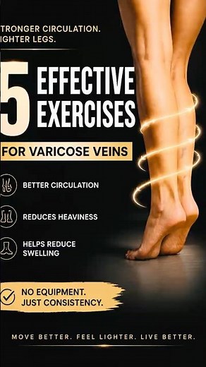 5 Effective Exercises for Varicose Veins | Reduce Leg Heaviness & Swelling