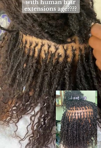 Understanding Microlocs Aging with Human Hair Extensions