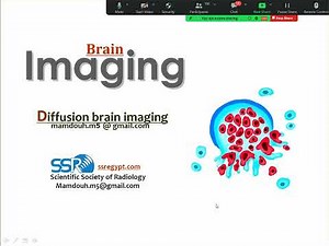 6 Diffusion MRI Brain TEC Prof Mamdouh Mahfouz