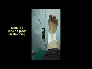 Entorse de la cheville : comment mettre un strapping