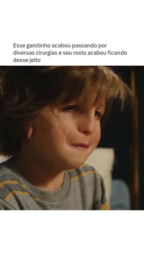 SEM SPOILER on Instagram: "August “Auggie” Pullman nasceu com uma síndrome genética rara que deformou seu rosto e o obrigou a passar por diversas cirurgias desde pequeno. Sempre protegido pela família, especialmente pela mãe Isabel, Auggie finalmente precisa enfrentar um grande desafio: frequentar a escola regular pela primeira vez. Ao ingressar no quinto ano, ele se depara com o preconceito, os olhares curiosos e a dificuldade de se encaixar em um ambiente totalmente novo. Enquanto lida com o b