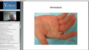 Use of Local Anesthesia in Hand Surgery