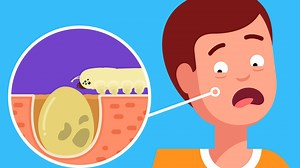 These bugs lay eggs in your face. | Insider Science