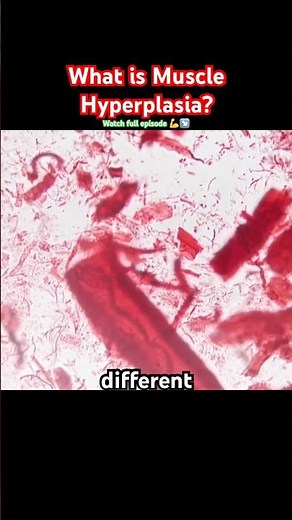 What is muscle hyperplasia?
