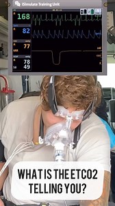 What is the ETCO2 telling you? #paramedic #paramedicstudent #ems #paramedicschool | Master Your Medics