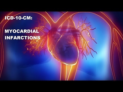 ICD-10-CM Myocardial Infarctions