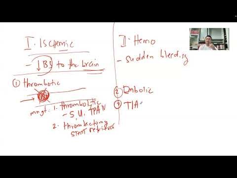 NEURO Series: Stroke