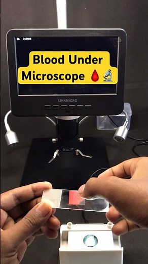 Blood Under Microscope | Preparing a Blood Sample slide | Slide from Blood Sample #linkmicro