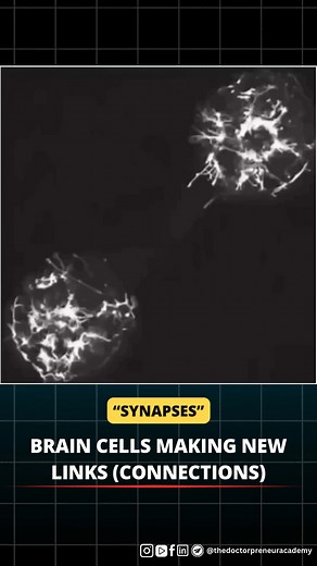 Brain cells making new connections (synapses) is called synaptogenesis. this happens when tiny branches of nerve cells (axons and dendrites) grow toward each other and join at a meeting point called a synapse. These new links help improve learning, memory, and adaptability. unlike neurotransmitters, which just pass signals, synapses physically connect nerve cells, making communication smoother and shaping how flexible the brain is. #brain #synaptogenesis #synapses #neuroscience #learning #memory