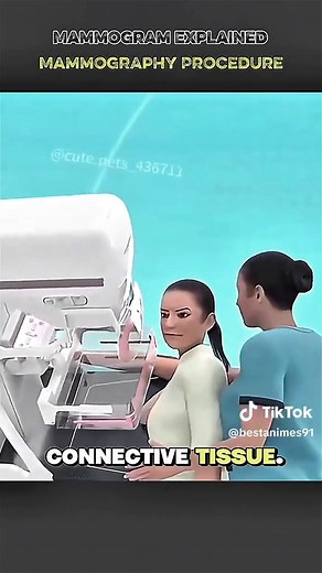 Understanding Mammogram Procedures for Breast Health