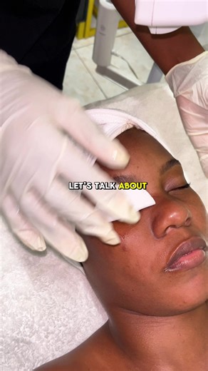 As a facial therapist, knowing how to do a proper skin analysis is so important for delivering effective treatments. If your ready to learn how to : - *Identify skin type*: - *Assess skin conditions*: - *Detect skin concerns*: l - *Develop a treatment plan*: Send us a message for course details , follow us to see more and save this video for later. #facial #course #montegobay #beautyschool #facialtherapycourse