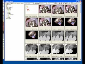 Incredible Power of the Image Organizer in TDO Software