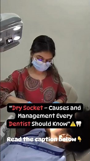 “Dry Socket – Why It Happens After Extraction?” 🦷⚠️ #doctor #trendingreels #dentalcare