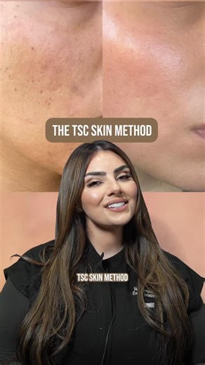 Nune Stepanyan, DNP, FNP-C | TSC Skin Method Program™ A comprehensive skincare plan fully customized to YOUR unique skin needs and concerns. A program like none... | Instagram