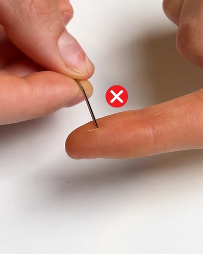 The easiest splinter removal you’ll see today | This Is Brainy