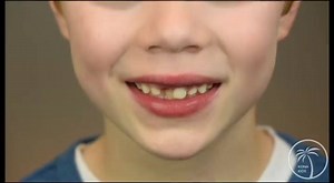 How to wiggle a baby tooth? Our son, Duncan, shows you the easy way! 󾌳 -DrB & DrK | Kona Kids Dentistry