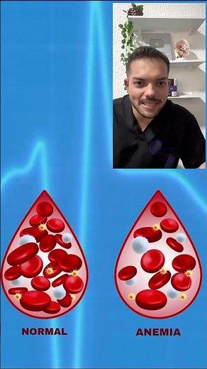 VITAFER - WHAT IT'S FOR, HOW TO TAKE IT, SIDE EFFECTS - MEDICATION FOR IRON DEFICIENCY ANEMIA