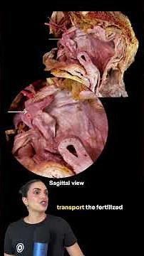 Anatomy of the Pelvis | Can you identify this structure? | Med School Bootcamp