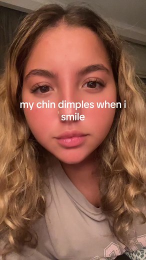 Exploring Chin Dimples: A Unique Smile Feature