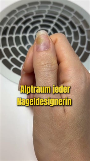 Bakterielle Infektion 🥲 #nails #nägel #lifting #gelnails