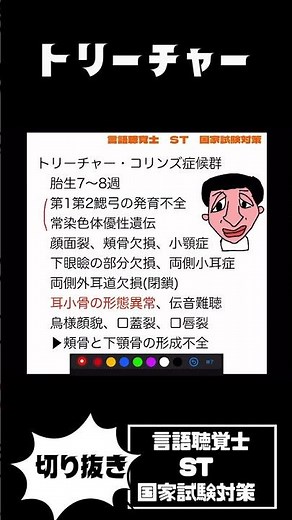 27-114 トリーチャー・コリンズ症候群 クルーゾン症候群 アペール症候群 ピエールロバン症候群 頭蓋縫合早期癒合症