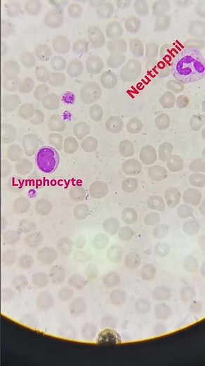 WBCs cells seen in microscope lymphocyte and Neutrophil #microscope #pathology #neutrophile