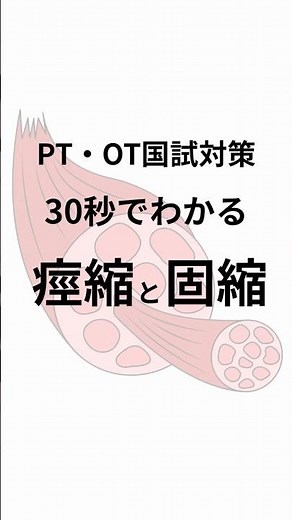 30秒でわかる痙縮と固縮 #shorts #理学療法士 #作業療法士 #国家試験対策