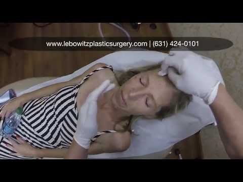Facial Injections (Botox/Radiesse/Juvederm) in Huntington, Long Island NY by Dr. Lebowitz