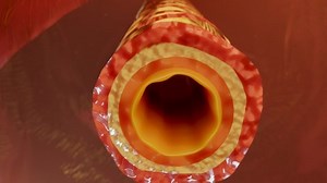 Asthma Symptoms, Treatment, Bronchiole, 3d render