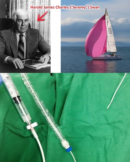 17K views · 169 reactions | Es interesante ver cómo el cable del...