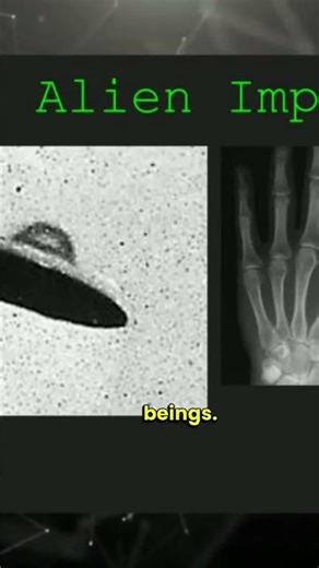 Alien Implants at Various Levels