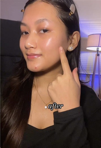 Revitalize Your Skin with COSRX Mist & Glow