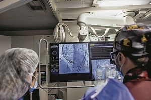 Καρδιά: Αλλαγή βαλβίδας χωρίς χειρουργική επέμβαση - Πέντε κρίσιμα ερωτήματα - ΤΑ ΝΕΑ