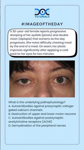 What is the underlying pathophysiology?