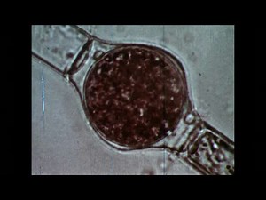 Microscopy of Algae: Pond Ecosystem & Plant Cells