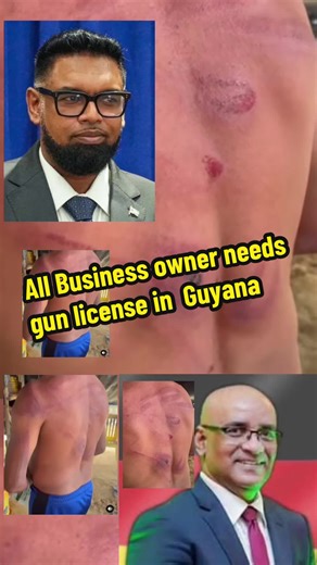 Business Owners in Guyana Advocated to Carry Weapons for Protection
