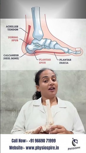 Heel Pain Explained 🔥 | Plantar Fasciitis vs Heel Spur vs Achilles Tendonitis