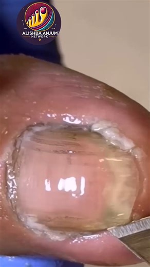 Expert Advice for Seniors to Clean Toenails Safely 💐🌺 #SafeSteps #DiabeticFootCare #SeniorHealth | Alishba Anjum vlog