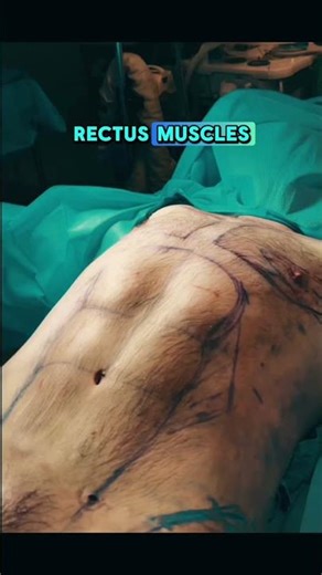 Talking HD Liposculpting