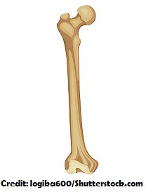 NCLEX Cast Care Review Question