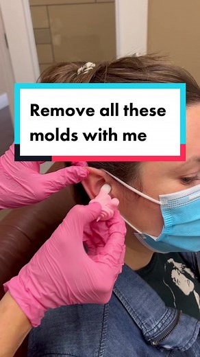 The Best Way to Remove Molds Easily