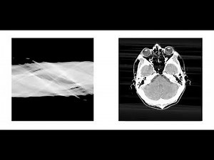 Filtered back-projection reconstruction of head slice