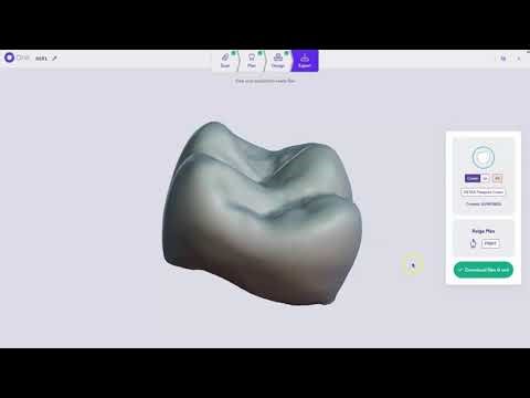 Circle One | Crown Workflow — Dexis & Amann Girrbach