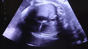 America First means supporting the RIGHT TO LIFE 🇺🇸 Join the fight to protect the lives of the unborn: secure.americafirstpolicy.com/stand-for-life | America First Policy Institute