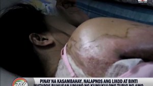 Maid allegedly burned by Saudi employer